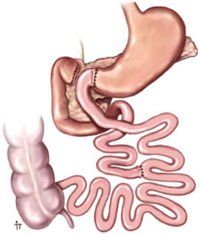 Cirurgia de Rubino em Curitiba