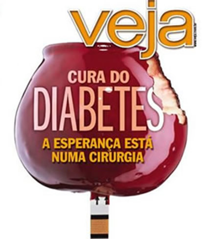 Cirurgia do Diabetes em Curitiba