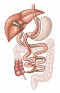 Duodenal Switch Curitiba