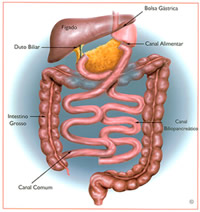 Cirurgia de Scopinaro em Curitiba